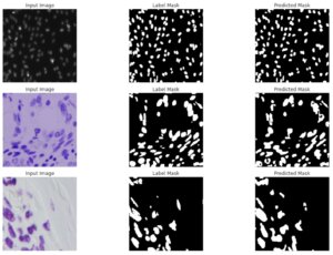U-netの使い方と具体的な実装方法について【細胞画像のSemantic segmentationを通して解説】